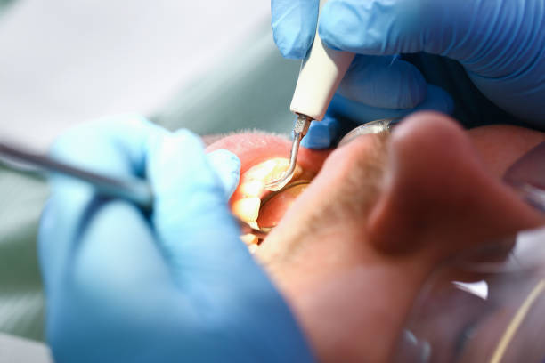 Best Broken or Cracked Tooth Emergency Dentist in Oak Valley, NJ